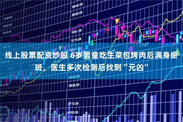 线上股票配资炒股 6岁男童吃生菜包烤肉后满身瘀斑，医生多次检测后找到“元凶”